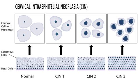 pap smear test partially obscuring thick areas are present|Management of Abnormal Cervical/Vaginal Pap Smears .